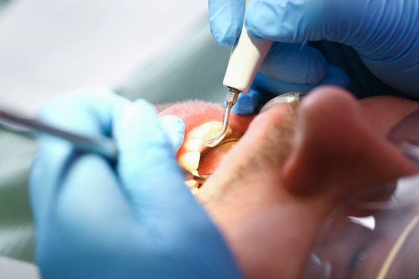 Best Weekend Emergency Dentist in Monroe, GA