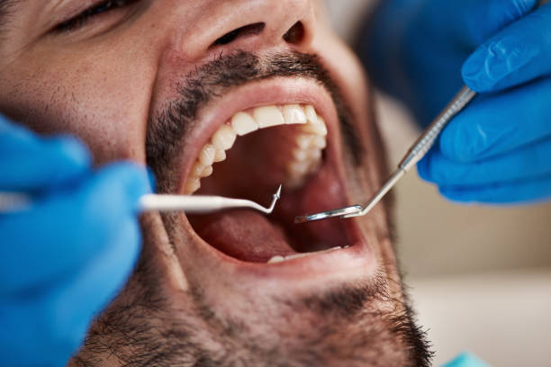 Best Emergency Root Canal Treatment in Monroe, GA